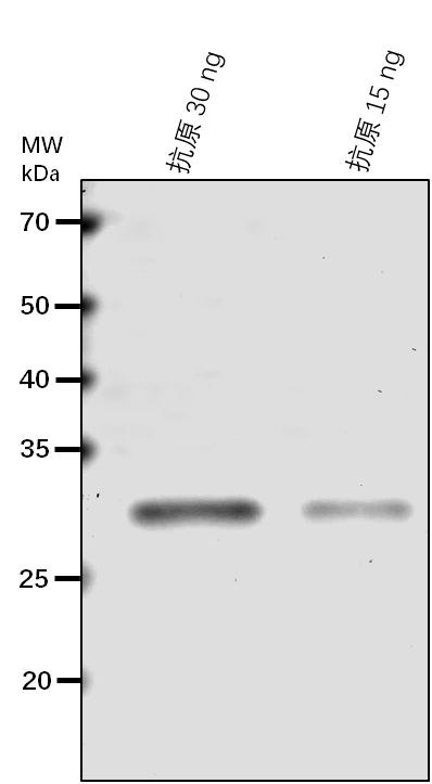 Anti-NOL/ Chlorophyll(ide) b reductase NOL, chloroplastic