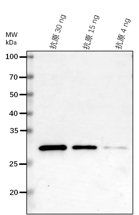 Anti-RPOB/ DNA-directed RNA polymerase subunit beta