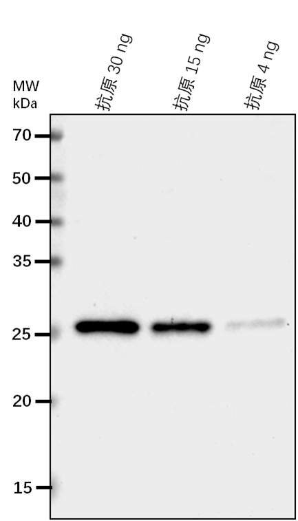 Anti-DHQS/ 3-dehydroquinate synthase, chloroplastic