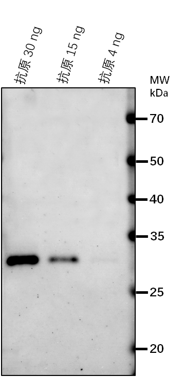 Anti-TIR1/ Protein TRANSPORT INHIBITOR RESPONSE 1