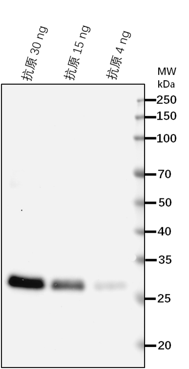 Anti-ZAR1/ Receptor protein kinase-like protein ZAR1