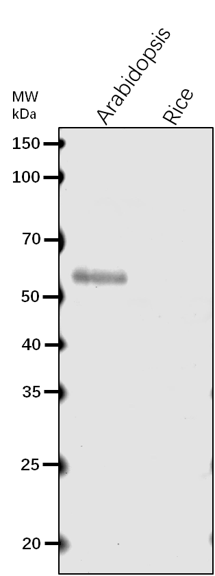 Anti-NS1/ Asparagine--tRNA ligase