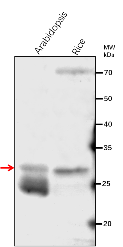 Anti-KR/ 3-oxoacyl-[acyl-carrier-protein] reductase