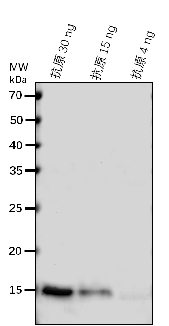 Anti-CCS/ Copper chaperone for superoxide dismutase