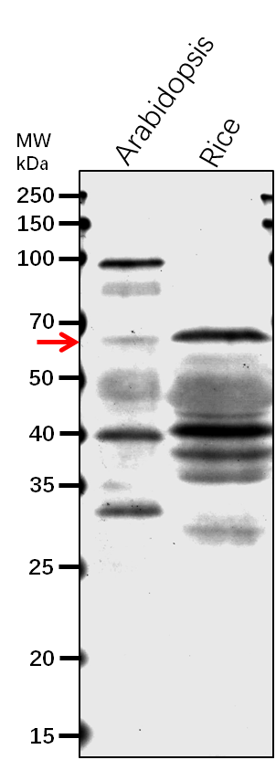 Anti-TIC62/ Protein TIC 62