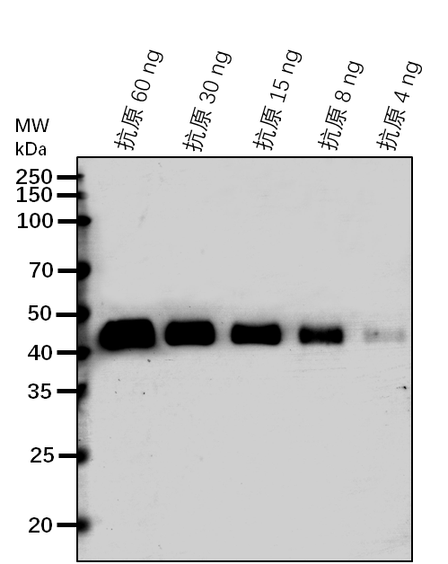 Anti-WIP1/ WPP domain-interacting protein 1