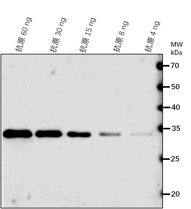 Anti-PECT1/ Ethanolamine-phosphate cytidylyltransferase