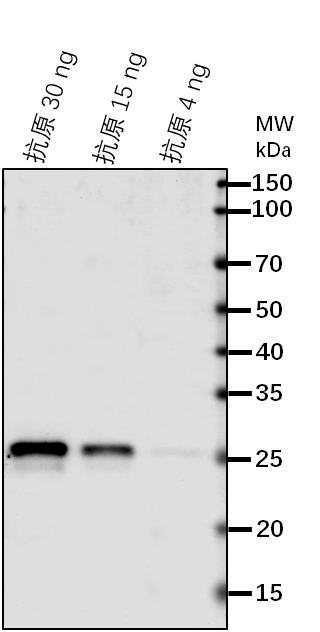Anti-OMP85/ Outer membrane OMP85 family protein