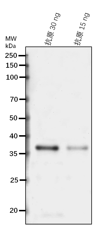 Anti-HY2/GUN3/ Phytochromobilin:ferredoxin oxidoreductase