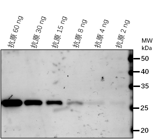 Anti-SUN2/ SUN domain-containing protein 2