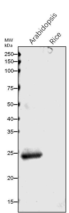 Anti-CA1/ Beta carbonic anhydrase 1 rabbit antibody