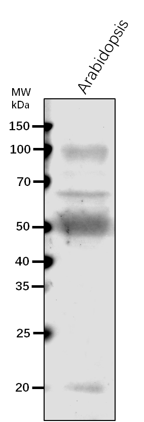 Anti-ClpT1/ ATP-dependent Clp protease ATP-binding subunit