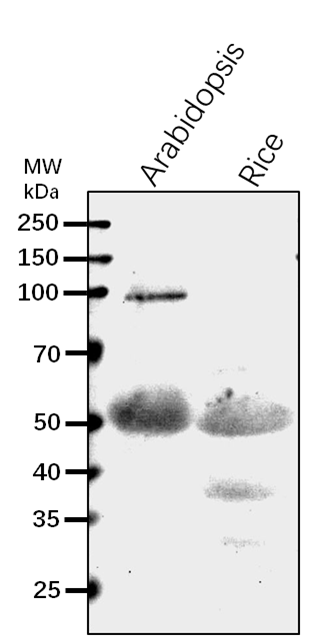Anti-F2KP/ Fructose-2,6-bisphosphatase