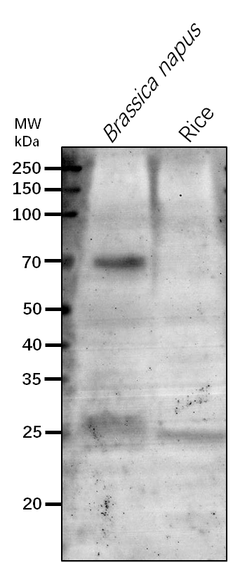 Anti-At1G71810/ aarF domain-containing protein kinase