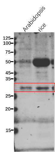 Anti-SK2 / Shikimate kinase 2 antibody