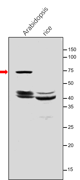 Anti-DXS / 1-deoxy-D-xylulose-5-phosphate synthase
