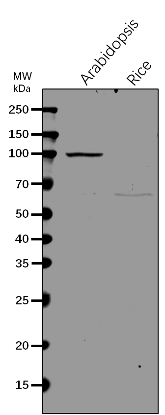 Anti-NAA15/N-terminal acetyltransferase A complex auxiliary