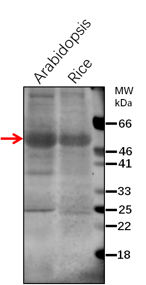 Anti-HXK1/ Hexokinase-1 Rabbit Antibody