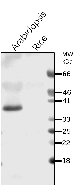 Anti-ARGAH2/Arginine Amidohydrolase 2 Rabbit Antibody