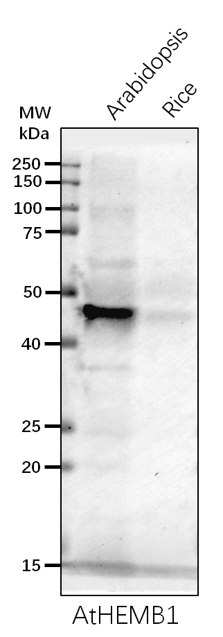 Anti- HEMB1/ALAD1/ Delta-aminolevulinic acid dehydratase 1