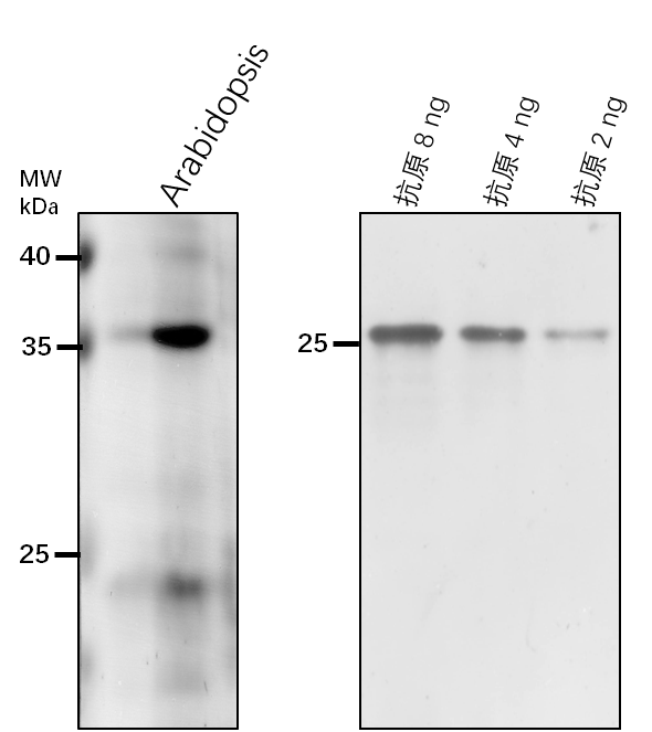 Anti-HSK/ Homoserine kinase