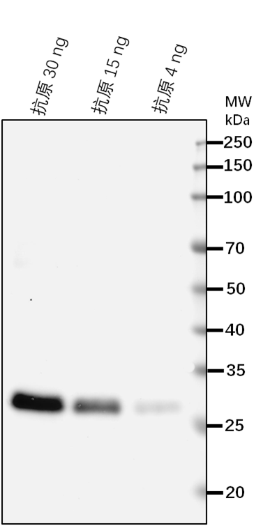 Anti-ZAR1/ Receptor protein kinase-like protein ZAR1