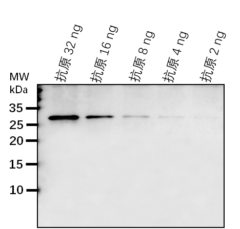 Anti-PRP31/ U4/U6 small nuclear ribonucleoprotein Prp31