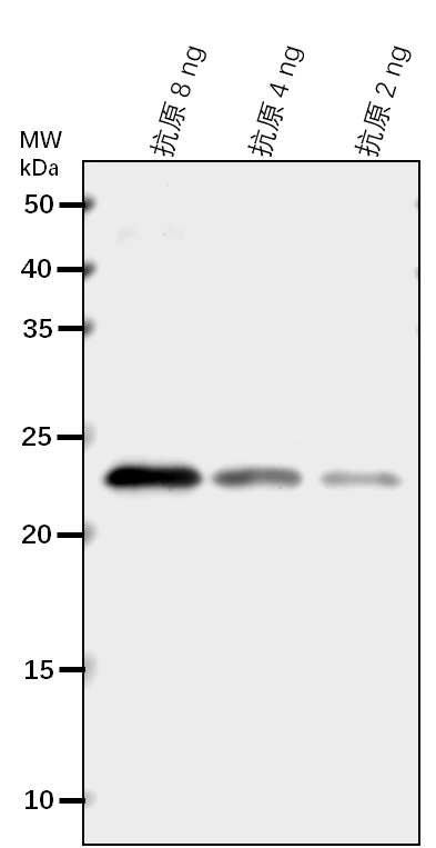Anti-ACCT2/ Acetyl-CoA acetyltransferase 2