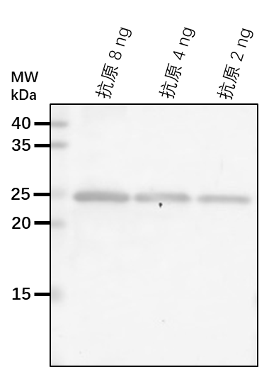Anti-PDV2/ Plastid division protein PDV2