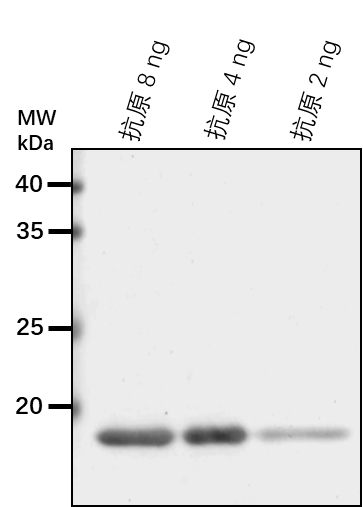 Anti-CRT2/ Calreticulin-2