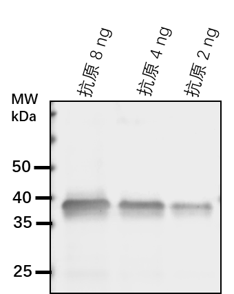 Anti-LINC1/ Protein LITTLE NUCLEI 1