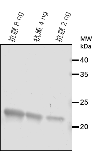 Anti-CPFTSY/ Cell division protein FtsY homolog, chloroplastic