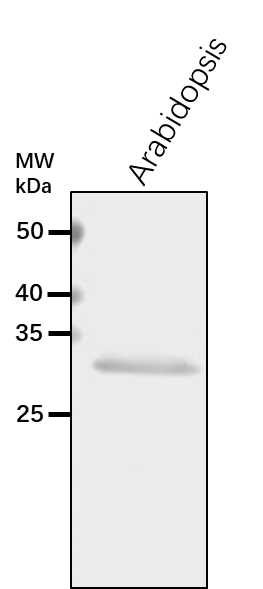 Anti-OASA1/ Cysteine synthase 1