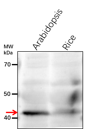 Anti-TIC40/ Protein TIC 40, chloroplastic