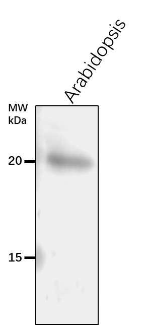 Anti-TIL/ Temperature-induced lipocalin-1